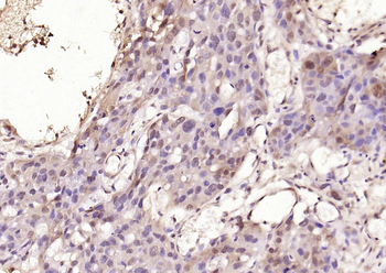 Phospho-Smad3 (Thr179) Rabbit Polyclonal Antibody