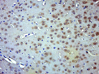 Phospho-Smad3 (Thr179) Rabbit Polyclonal Antibody