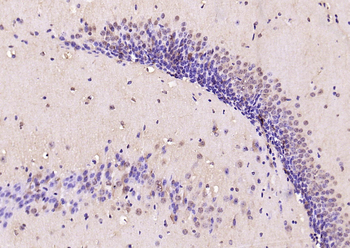 Phospho-Smad3 (Thr179) Rabbit Polyclonal Antibody