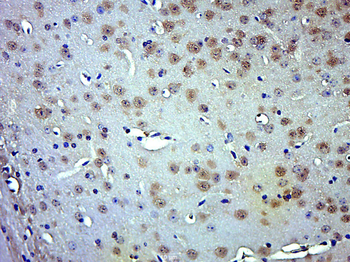 Phospho-Smad3 (Thr179) Rabbit Polyclonal Antibody