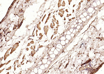 Phospho-Smad3 (Thr179) Rabbit Polyclonal Antibody