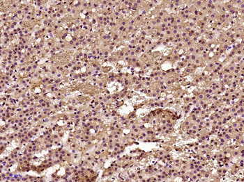 Phospho-Smad3 (Thr179) Rabbit Polyclonal Antibody