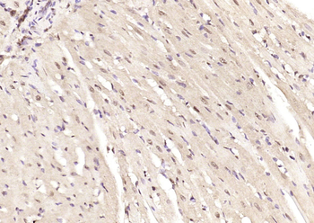 SMARCC1 Rabbit Polyclonal Antibody