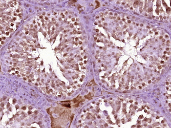 SMCHD1 Rabbit Polyclonal Antibody