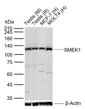 SMEK1 Rabbit Polyclonal Antibody