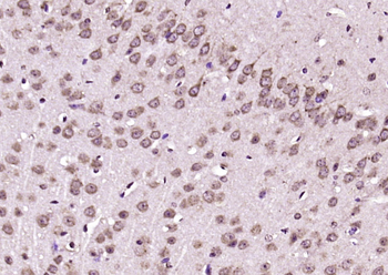 SMPD4 Rabbit Polyclonal Antibody