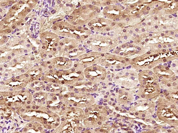 SMYD5 Rabbit Polyclonal Antibody