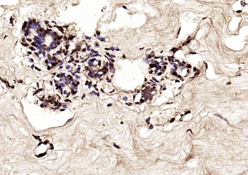 SMAD8/SMAD9 Rabbit Polyclonal Antibody