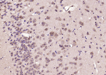 SMAD8/SMAD9 Rabbit Polyclonal Antibody