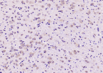 SMAD8/SMAD9 Rabbit Polyclonal Antibody