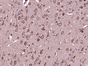 Survivin 3 alpha Rabbit Polyclonal Antibody