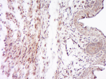 SOCS7 Rabbit Polyclonal Antibody