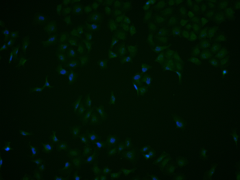 STAT2 Rabbit Polyclonal Antibody