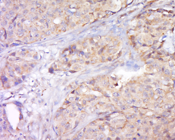 STAT2 Rabbit Polyclonal Antibody