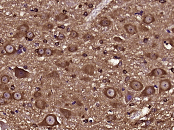 SPINK13 Rabbit Polyclonal Antibody