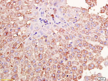 TIMP-1 Rabbit Polyclonal Antibody