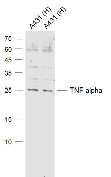 TNF alpha Rabbit Polyclonal Antibody