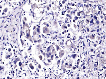 TREM2 Rabbit Polyclonal Antibody