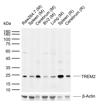 TREM2 Rabbit Polyclonal Antibody