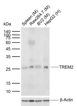 TREM2 Rabbit Polyclonal Antibody