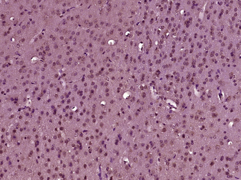 Tyrosine Hydroxylase Rabbit Polyclonal Antibody