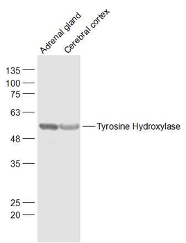 Tyrosine Hydroxylase Rabbit Polyclonal Antibody