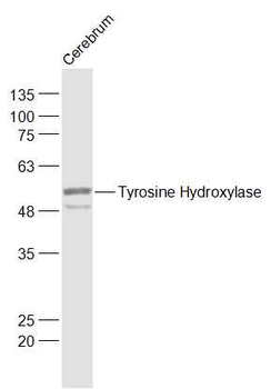 Tyrosine Hydroxylase Rabbit Polyclonal Antibody