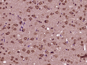 TMPRSS3 Rabbit Polyclonal Antibody