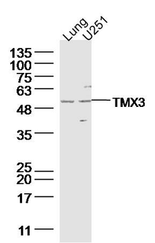 TMX3 Rabbit Polyclonal Antibody