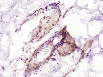 TCF7L1 Rabbit Polyclonal Antibody