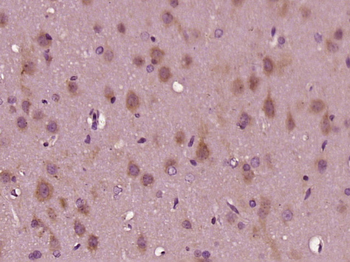 Tankyrase 2 Rabbit Polyclonal Antibody