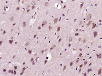 Phospho-TBC1D4 (Ser588) Rabbit Polyclonal Antibody