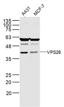 VPS26 Rabbit Polyclonal Antibody