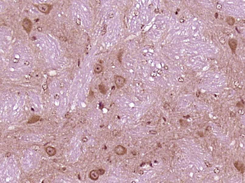 VPS29 Rabbit Polyclonal Antibody