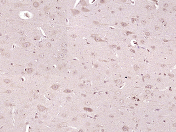 VPS35 Rabbit Polyclonal Antibody