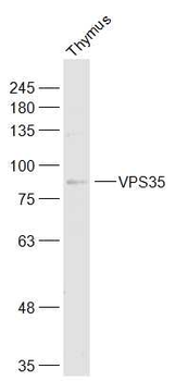 VPS35 Rabbit Polyclonal Antibody