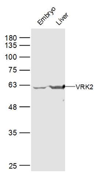 VRK2 Rabbit Polyclonal Antibody