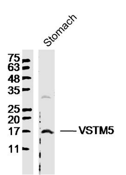VSTM5 Rabbit Polyclonal Antibody