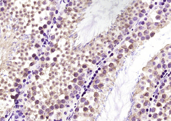 VTI1B Rabbit Polyclonal Antibody