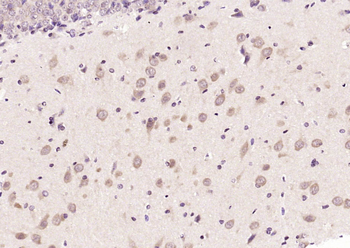 VTI1B Rabbit Polyclonal Antibody