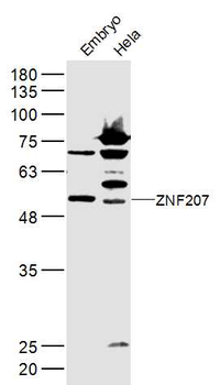ZNF207 Rabbit Polyclonal Antibody