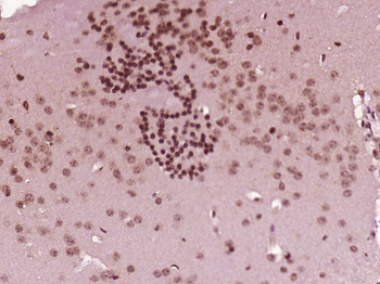 ZNF496 Rabbit Polyclonal Antibody