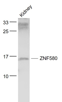 ZNF580 Rabbit Polyclonal Antibody