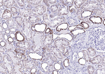 Sclerostin Rabbit Polyclonal Antibody