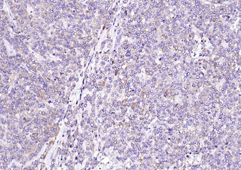 Sclerostin Rabbit Polyclonal Antibody