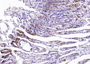 Sclerostin Rabbit Polyclonal Antibody