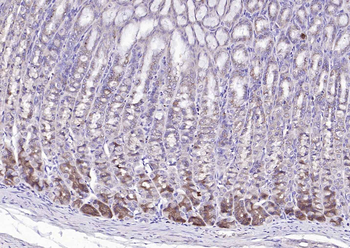 Sclerostin Rabbit Polyclonal Antibody