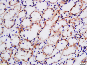 Adiponectin Mouse Monoclonal Antibody