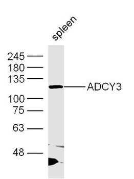 ADCY3 Rabbit Polyclonal Antibody