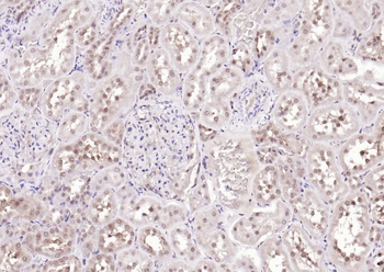 ANKRD54 Rabbit Polyclonal Antibody